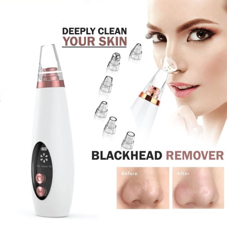 blackheads remover